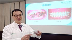 台南老菸槍嚴重牙周病  植牙搭配活動假牙助改善台南市一名男子因長期嚼檳榔及抽菸導致全口嚴重牙周病，就醫時已只剩3顆牙齒可以保留，奇美醫院牙醫部主治醫師邱武平（圖）26日受訪表示，個案經植牙搭配活動假牙治療後已成功改善進食狀況。中央社記者楊思瑞攝  112年12月26日