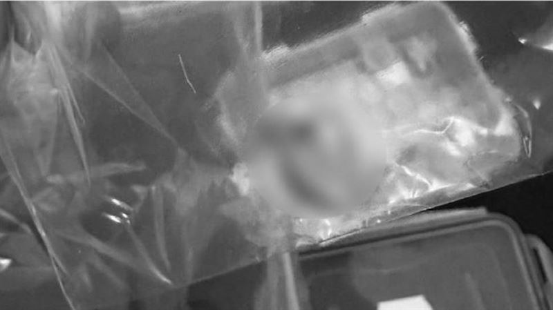 尋獲台東斷指主人…里長：接不回去了