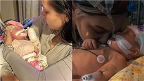 5月大女嬰「天生無眼」！左腦發育不全被切除　母淚曝奇蹟：她能說話（圖／翻攝自Allyanna Carter 臉書）