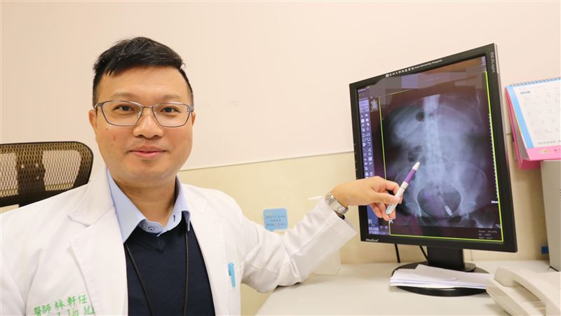 保骨吃維他命D注意了！男補過頭竟昏迷