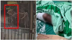 竹北氣爆,少年,燒傷,照片（圖／家屬提供、資料畫面）