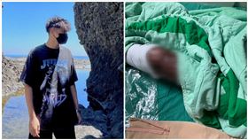 竹北氣爆,少年,燒傷,照片（圖／家屬提供）