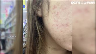 買到假貨！洗面乳害臉紅腫盼不再有人受害