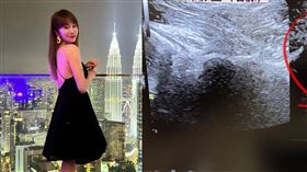 林佩瑤曬出一組超音波照被誤會要生了。