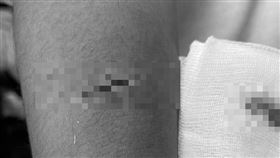 國中生持彈簧刀砍同學！留10公分傷口　台南教育局曝下場。受害學生家長提供