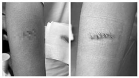 彈簧刀,國中生,學校,傷口