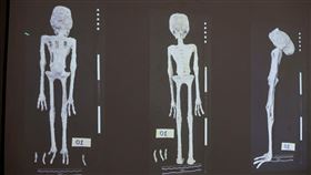 秘魯法醫學研究所對「外星人」遺體，進行X光檢查和研究，結論是是用動物骨頭等5種物質製成的玩偶（圖／路透／達志影像）