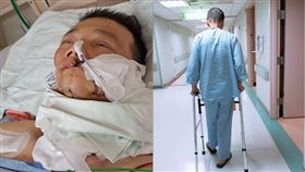 口腔癌,陽光基金會(陽光基金會 提供)