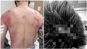 Toyz「頭破一大洞」傷口照曝光！網一看嚇傻怒轟超哥：要殺人是不是?（圖／翻攝自林一泓臉書）