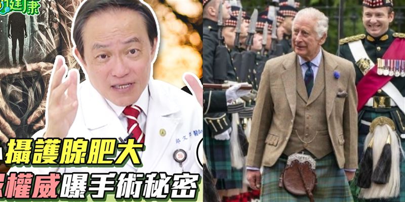 英國國王開攝護腺肥大手術　醫警告8件事