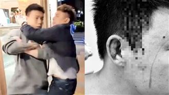 超哥：我要把你殺了！Toyz：硬物往頭攻擊