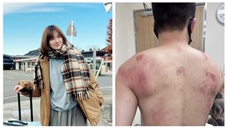 Toyz遭痛毆　昔告白愛你！陳沂開批超哥