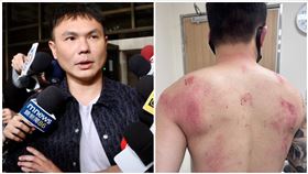 超哥,Toyz,網紅,出國,交保,狂毆,椅子