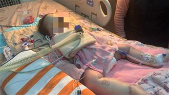 男嬰遭口罩悶死　父母同意器捐遺愛人間