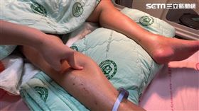 輕熟女腹痛腦病變　醫揪病因是偉大模仿者（圖／亞大提供）