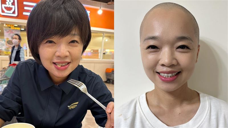 41歲女鄉長罹乳癌　曬光頭照：覺得很可愛