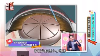 白內障患者有福了　新型微創手術恢復快