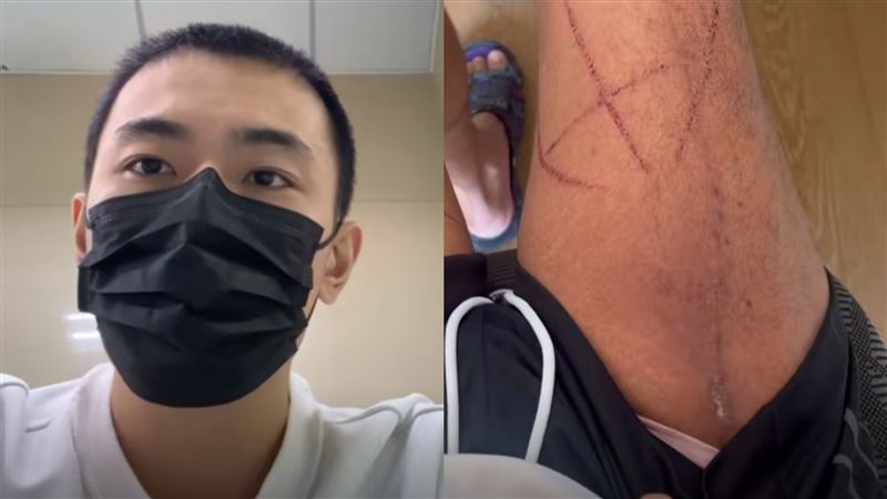 34歲男星惡性腫瘤恐截肢　痛喊世界崩塌了