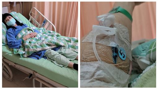 馬妞12重疾！已處理壽衣遺囑…家屬超難過