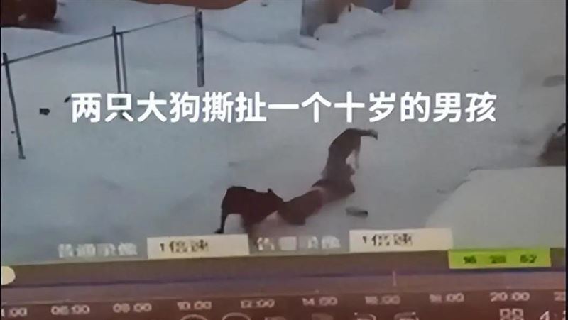 2惡犬攻擊10歲男童　全身40處撕咬傷截肢