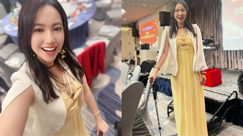 超偶女星摔落舞台　2根骨頭斷裂傷勢曝光