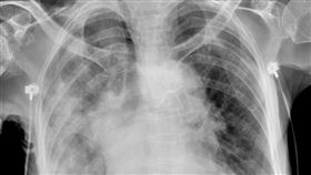 蘇一峰指出，過年期間感染心冠肺炎的患者數上升2、3成。（圖／翻攝自蘇一峰臉書）