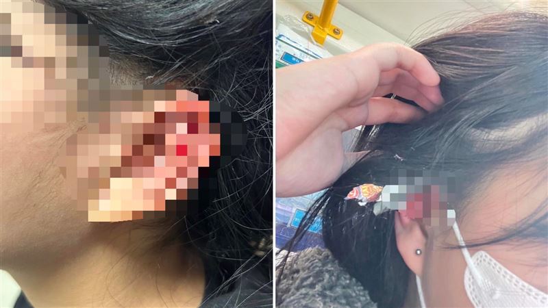 少女三峽長福橋上遭爆竹炸破耳　尋目擊者