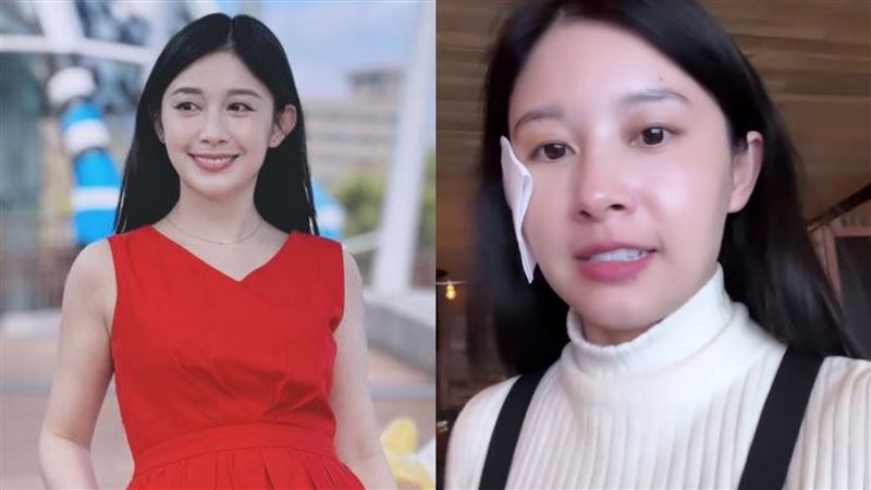 占星界女神出事了　白瑜追極光毀容慘況曝