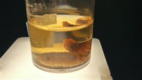 3隻2.5公分大的馬蠅幼蟲，在患者嘴唇裡鑽來鑽去。（圖／記者簡浩正攝影）