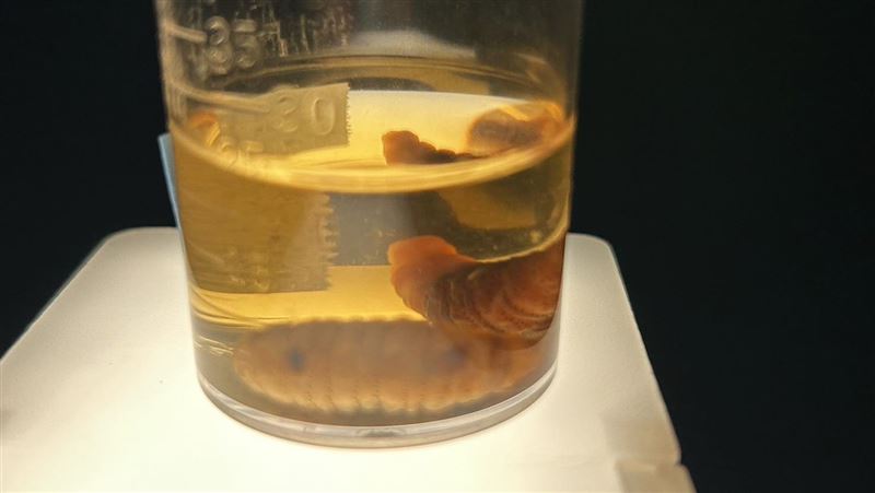 慎入！男遊祕魯被馬蠅叮　嘴唇孵出3肥蟲