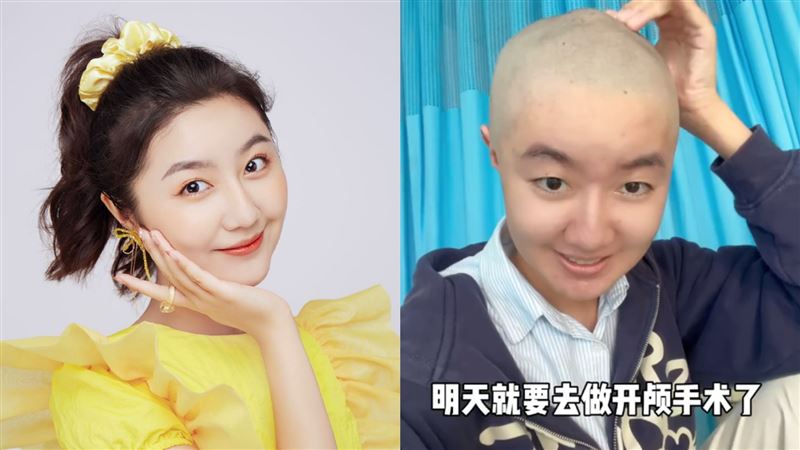 女星消失7個月！再出現剃頭宣布開顱手術