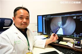 人人為食道逆流所苦　一招「關門」抗逆流（圖／翻攝畫面）