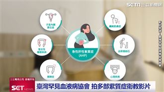 腹痛心悸找無病因　恐患急性間歇性紫質症