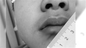 台東／放學「打寶可夢機台」遭嗆玩很爛！小六童竟「持刀架同學脖子」割傷嘴唇（圖／翻攝自陳允萍臉書）