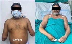 男遭火車撞上截雙臂　4年後接回女手臂(圖/翻攝畫面)