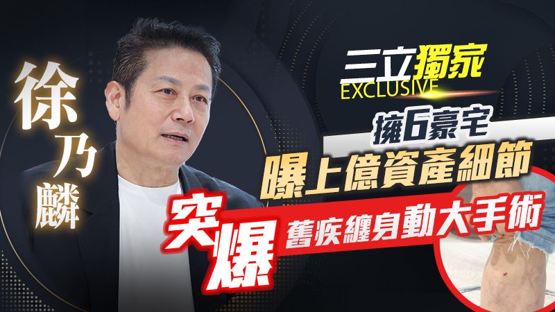 獨／突爆惡疾動大手術　乃哥驚揭術後病況