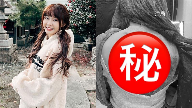 樂天女孩Yuri怎麼了？後背皮開肉綻超驚悚