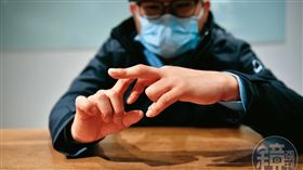 黃先生的手指肌腱被員警拗斷，造成永久性的傷害。