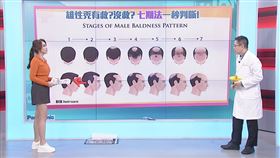 掉髮,飲食,禿頭,護髮,食材,手搖飲,心血管疾病