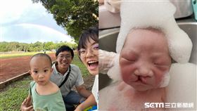 【顱顏專題】－阿炮