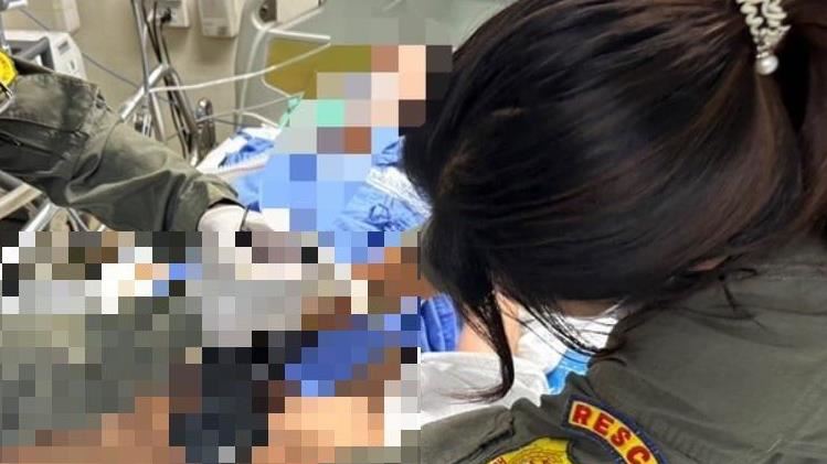 男下體狂套11鋼環昏迷　送醫慘出動切割機