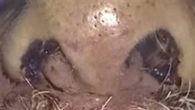 男不舒服4個月…鼻血流不停才求醫「竟夾出150條活蟲」！驚悚畫面曝光（圖／翻攝自 First Coast News YouTube）