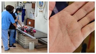 飯店地毯有碎玻璃！小孩撿起吃「滿嘴血」