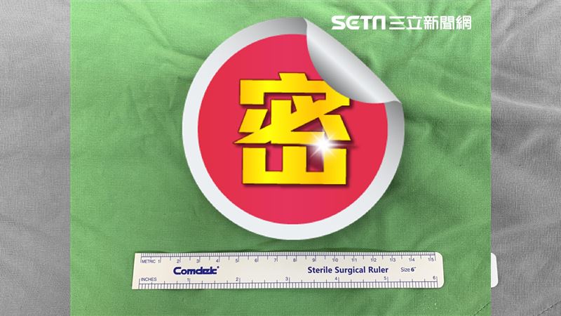 男剖腹取肛門塞入異物　「當事椰子」曝光