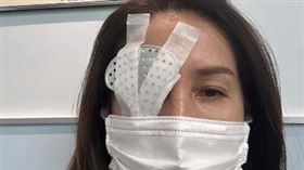 高金素梅PO出眼睛開刀後右眼包紮獨眼照片（圖／翻攝自臉書）