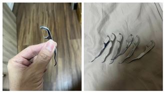 牙線棒用1週才換…「心臟瓣膜被吃掉」！