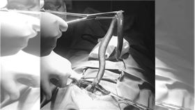 鰻魚，鑽肚（圖／翻攝ODDITYCENTRAL）