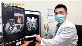 宋文瑋醫師強調，多數腎結石病患並沒有任何疾病症狀，建議民眾定期去醫院進行超音波或X光檢查，隨時追蹤身體狀況。