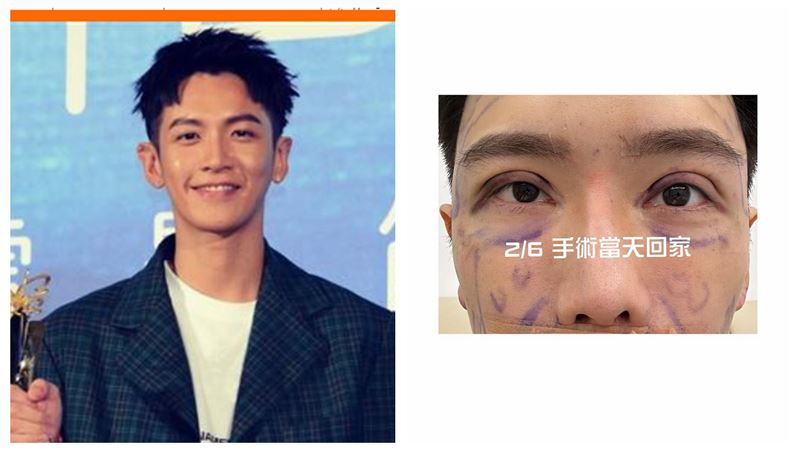 小吳自爆整形　比對照網驚：整完像柯震東