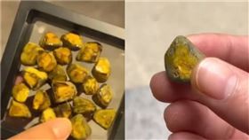 29歲女子取「21顆膽結石」隨時放身上把玩　她自嘲：絕版品（圖／微博）